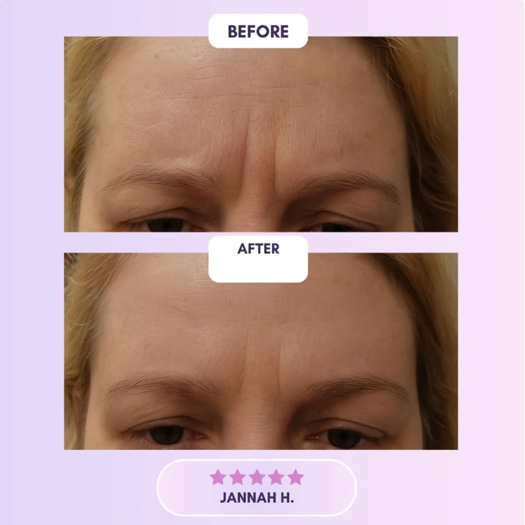 Collagen Skin Sheets - Loria